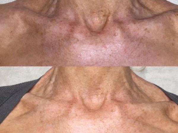 Sticking your NECK out there!